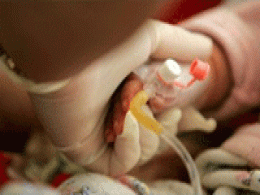 Govt floats draft note on relaxing FDI in medical devices