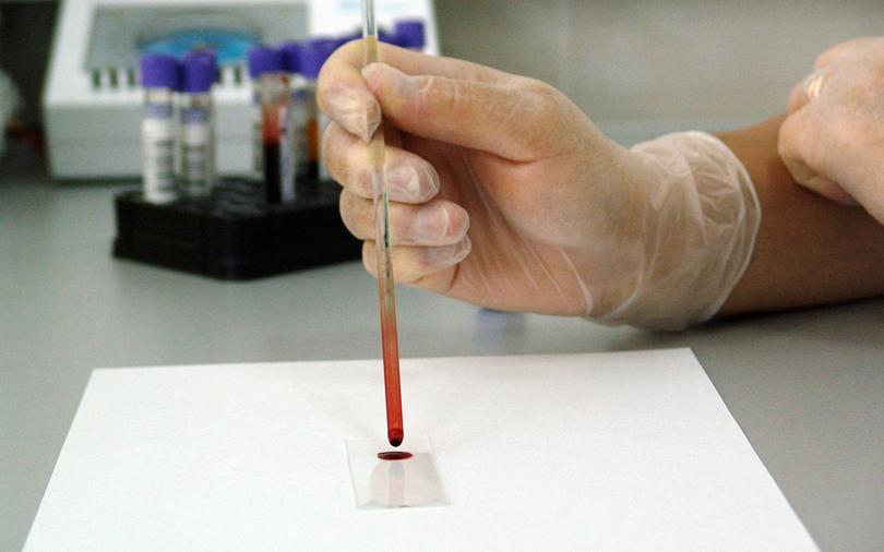 HCG combines clinical lab services unit with Strand Life Sciences